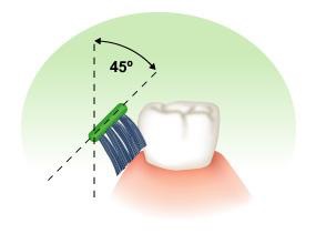 toothbrush angle Fayetteville Arkansas dentistry