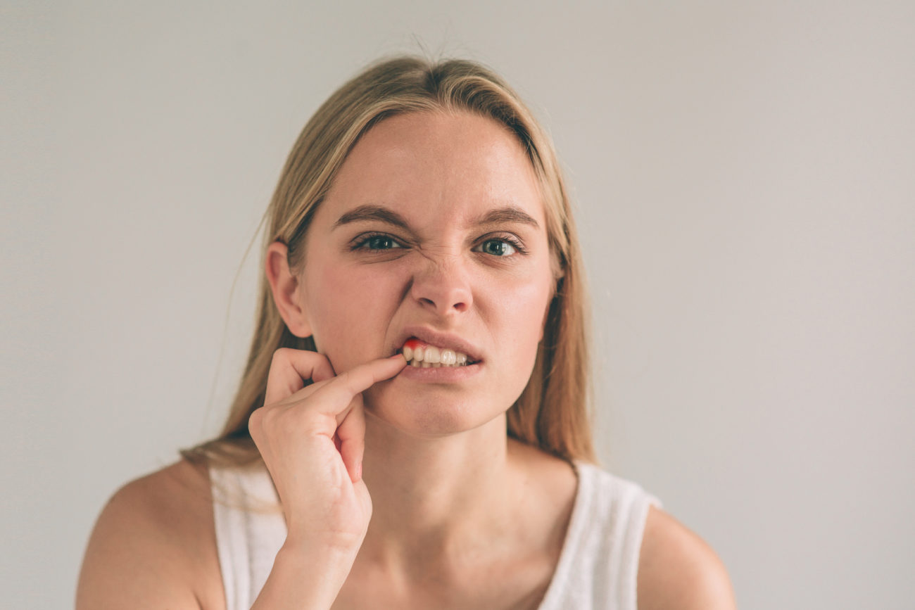 Bleeding Gums Fayetteville, AR gum health