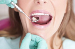 Answering Gum Disease Questions in Fayetteville, AR