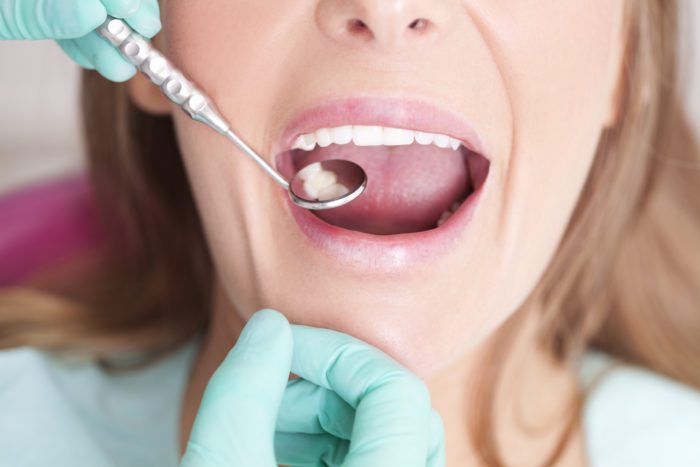 Answering Gum Disease Questions in Fayetteville, AR