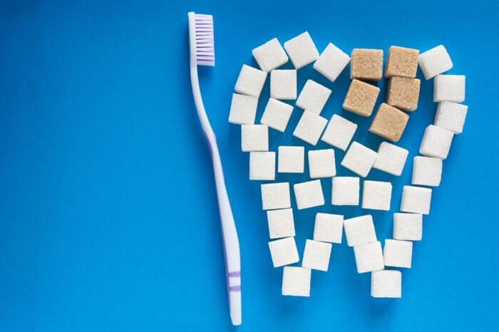 Why Sugar is Bad For Teeth