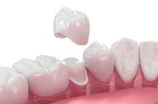 Understanding how to care for your new dental crown can help you avoid complications and keep your mouth healthy in the long run.