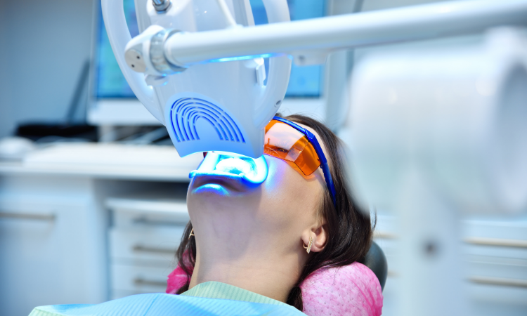 When it comes to achieving safe, effective, and lasting results, professional teeth whitening stands out as the superior choice.