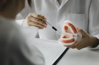 The Lifespan of Dental Restorations in Fayetteville, AR